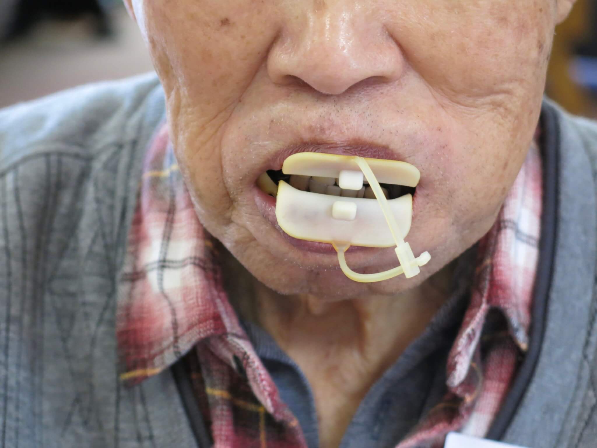 クチトレプラスはどんな特長がありますか -